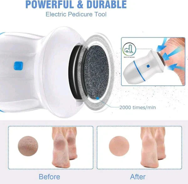 SmoothStep Electric Foot Callus Remover - Effortless Foot Care Brand New Asprda 