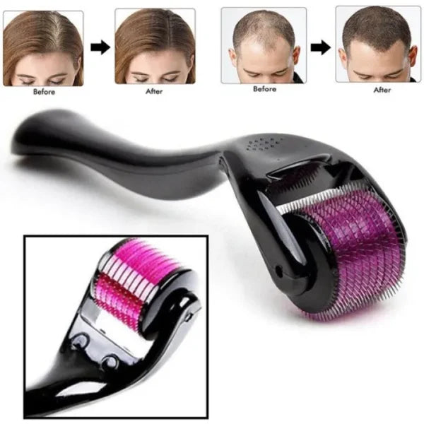 Derma Roller 0.5mm – Transform Your Hair & Skin Naturally! Brand New My Store 